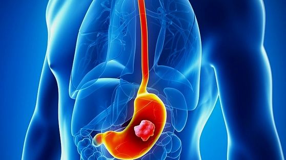 فاجعه زمستانی در کمین است: چگونه در دام نوروویروس سمی قرار نگیریم